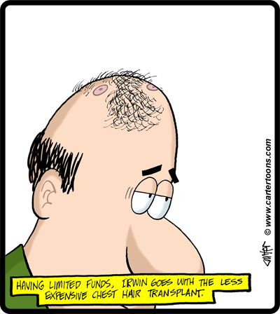 Chest Hair Transplant -